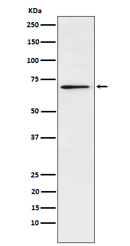 L-Plastin Antibody in Western Blot (WB)