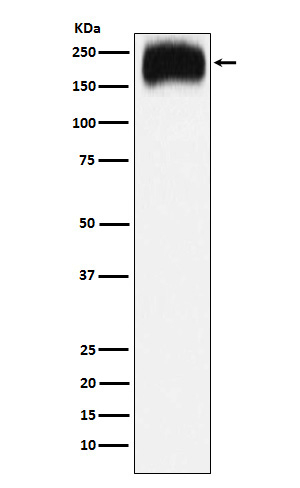 NPC1 Antibody in Western Blot (WB)