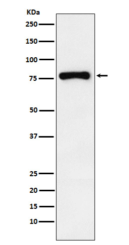 RNaseL Antibody in Western Blot (WB)