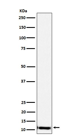 SPINK1 Antibody in Western Blot (WB)