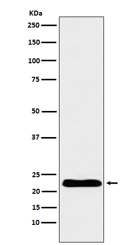 Troponin I Antibody in Western Blot (WB)