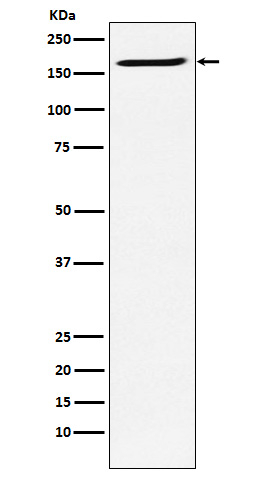 SMC4 Antibody in Western Blot (WB)