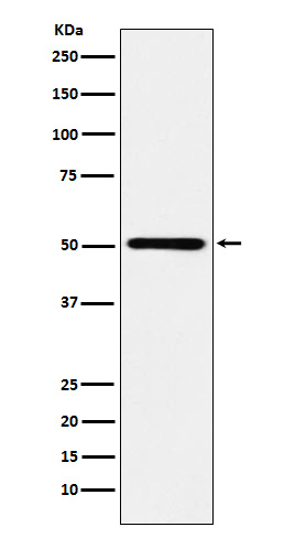 RING1 Antibody in Western Blot (WB)