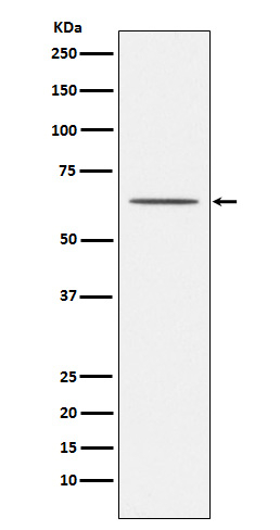 Nogo Receptor Antibody in Western Blot (WB)