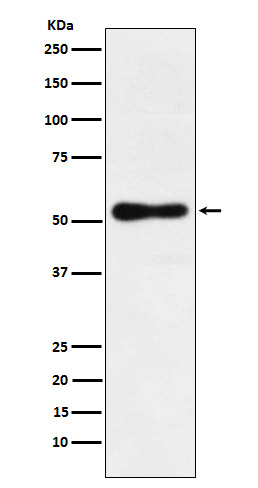 RORB Antibody in Western Blot (WB)