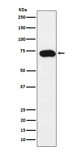 SLC22A1 Antibody in Western Blot (WB)