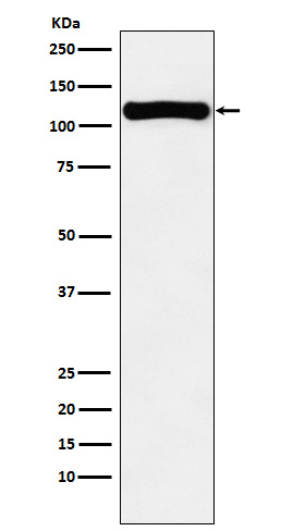 VPS11 Antibody in Western Blot (WB)