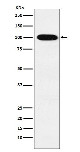 VPS18 Antibody in Western Blot (WB)