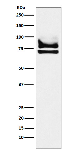 DDX17 Antibody in Western Blot (WB)