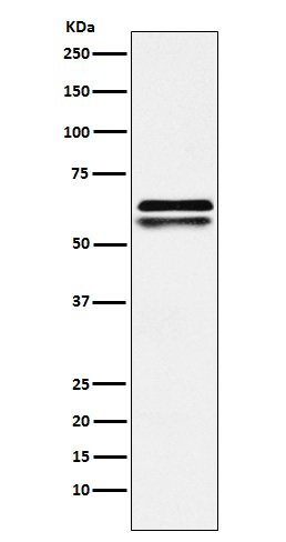 NAP1L1 Antibody in Western Blot (WB)