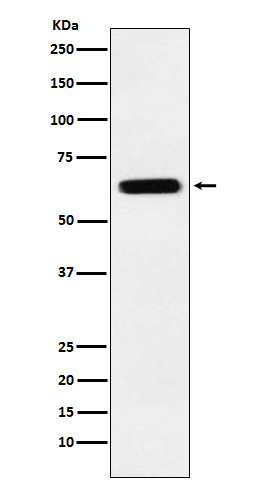 CRMP5 Antibody in Western Blot (WB)