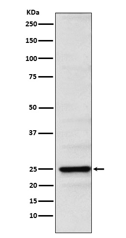 Neurogenin 2 Antibody in Western Blot (WB)