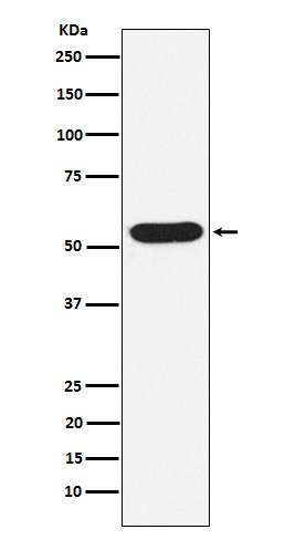 WASP Antibody in Western Blot (WB)