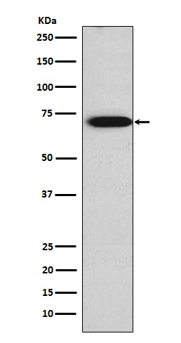 TRIM29 Antibody in Western Blot (WB)