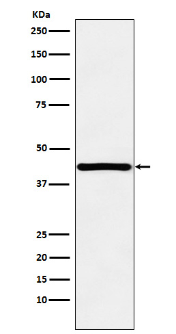 HOXA13 Antibody in Western Blot (WB)