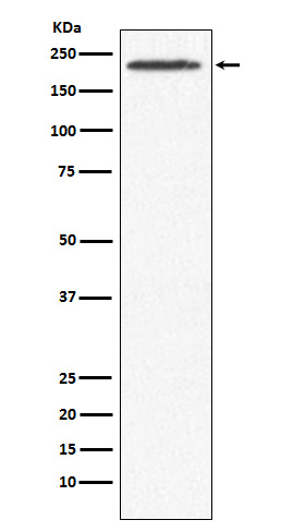 SMCHD1 Antibody in Western Blot (WB)