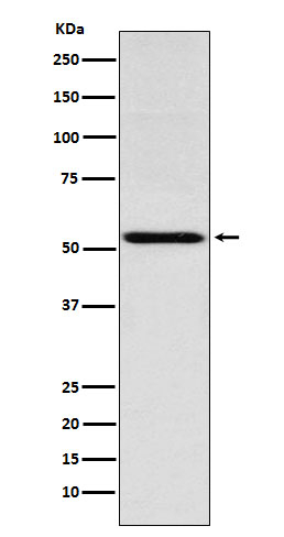 THRA Antibody in Western Blot (WB)