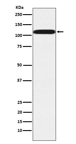 PUM2 Antibody in Western Blot (WB)