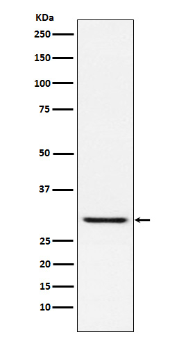 TIRAP Antibody in Western Blot (WB)