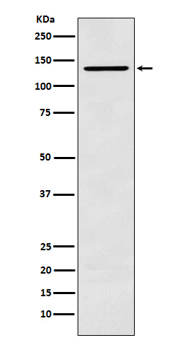 CARD11 Antibody in Western Blot (WB)
