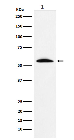 GGT1 Antibody in Western Blot (WB)