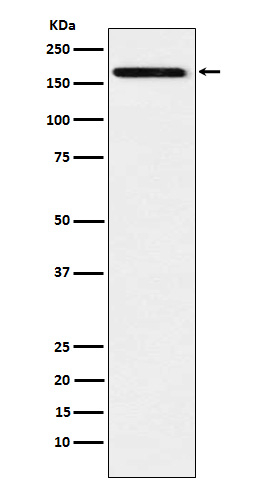 IL17RA Antibody in Western Blot (WB)