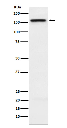 KIF4A Antibody in Western Blot (WB)