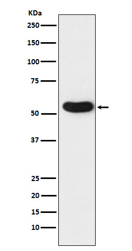 CHRNA5 Antibody in Western Blot (WB)