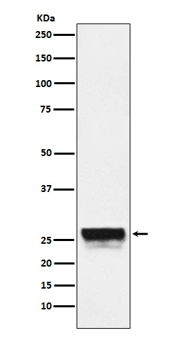 CTRL Antibody in Western Blot (WB)