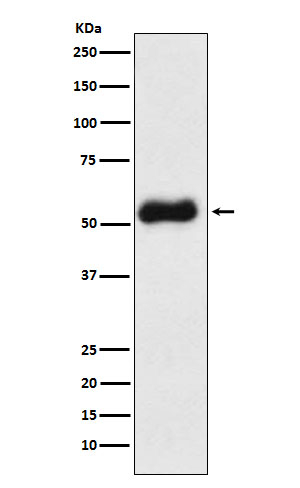 Thromboxane synthase Antibody in Western Blot (WB)