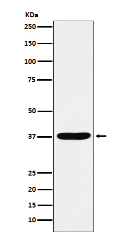 AKR1C1/AKR1C2 Antibody in Western Blot (WB)