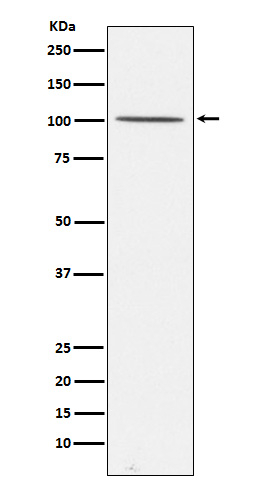 Gemin 3 Antibody in Western Blot (WB)