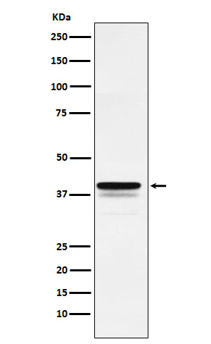 FOXF1 Antibody in Western Blot (WB)