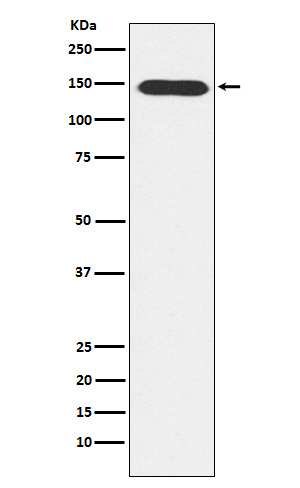 PLCB3 Antibody in Western Blot (WB)