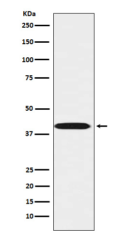 LHX3 Antibody in Western Blot (WB)