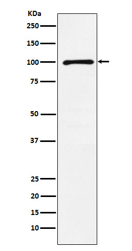 GluR6 Antibody in Western Blot (WB)