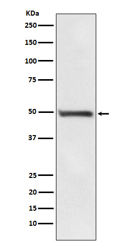 RAD52 Antibody in Western Blot (WB)