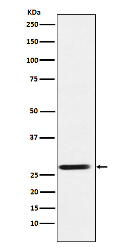 SRD5A2 Antibody in Western Blot (WB)