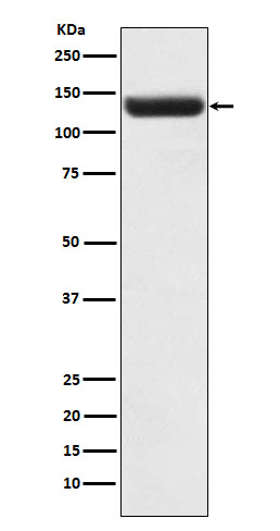 ZNF217 Antibody in Western Blot (WB)