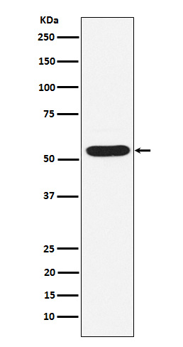 PIAS2 Antibody in Western Blot (WB)