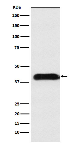 M6PR Antibody in Western Blot (WB)