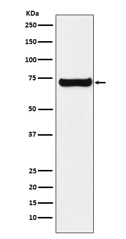 SESN1 Antibody in Western Blot (WB)