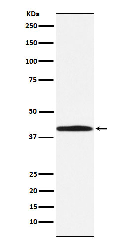 ABO Antibody in Western Blot (WB)