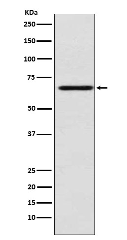 MAdCAM-1 Antibody in Western Blot (WB)