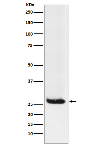 Hippocalcin Antibody in Western Blot (WB)