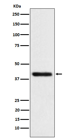 TMOD2 Antibody in Western Blot (WB)