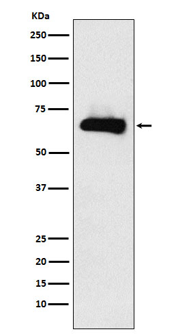 DPYSL3 Antibody in Western Blot (WB)