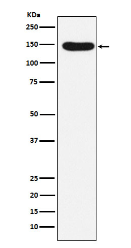 Desmoglein 3 Antibody in Western Blot (WB)