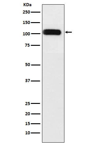 SERCA1 ATPase Antibody in Western Blot (WB)