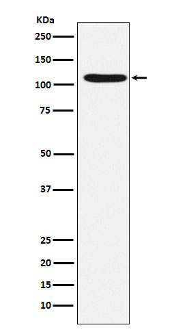 HIRA Antibody in Western Blot (WB)
